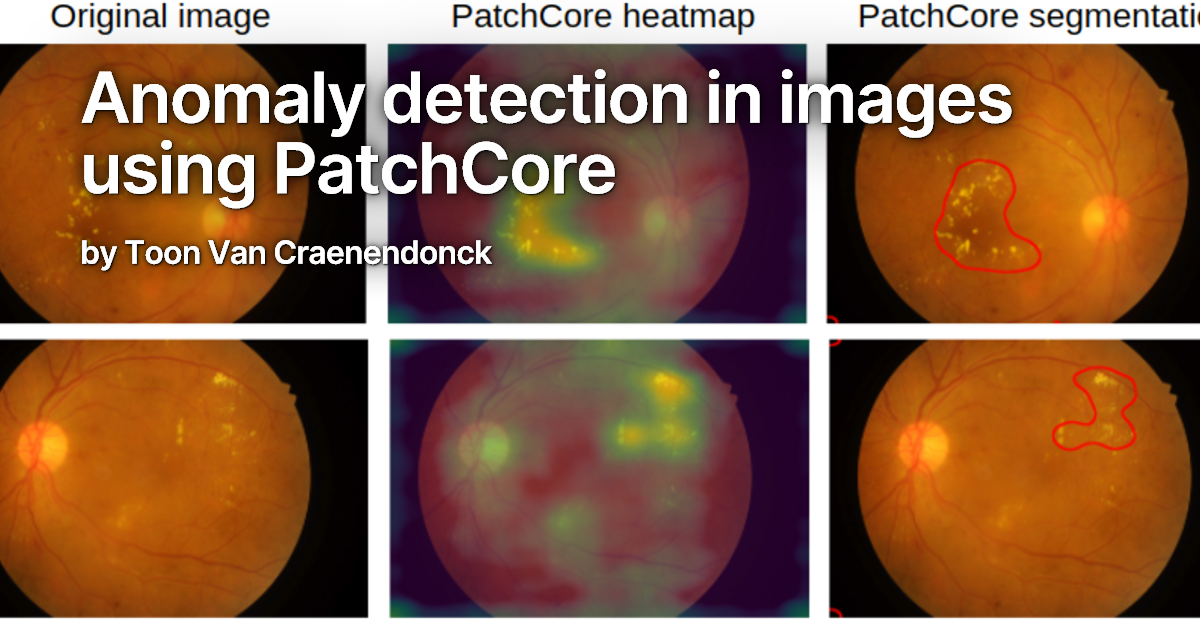 Anomaly detection in images using PatchCore